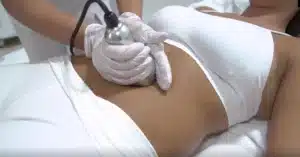 Ultrasonic Cavitation
