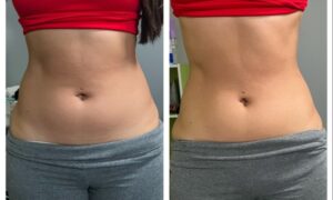 Results From Cavitation