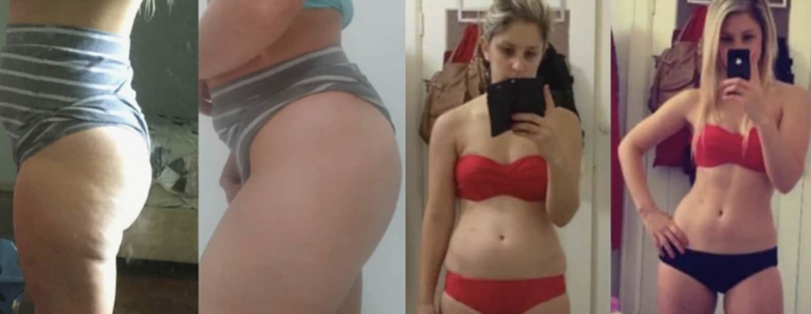 NuLife Beauty Ultrasonic Fat Burner Before and After Results