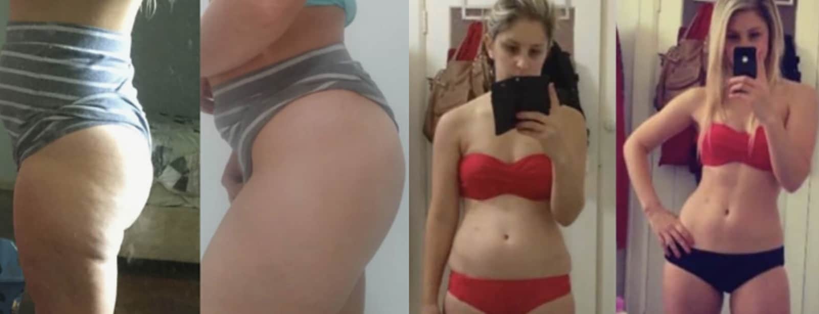 iSlim Pro Cellulite Remover Before and After Results