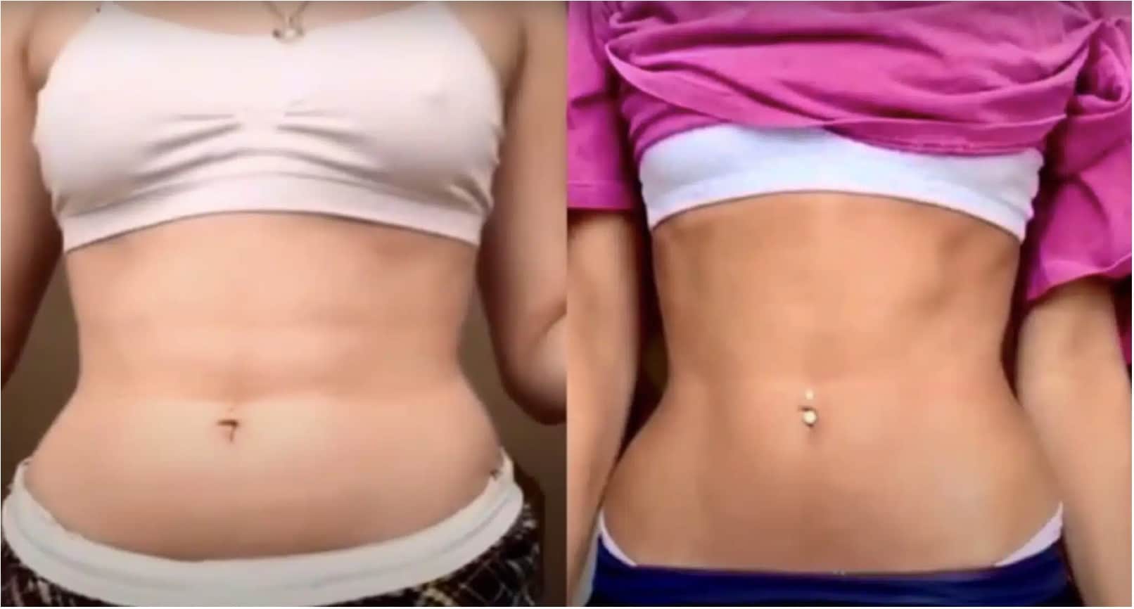 CaviPRO before and after results