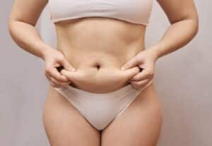 Cellulite on Your Stomach