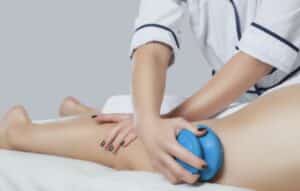 Cupping for Cellulite