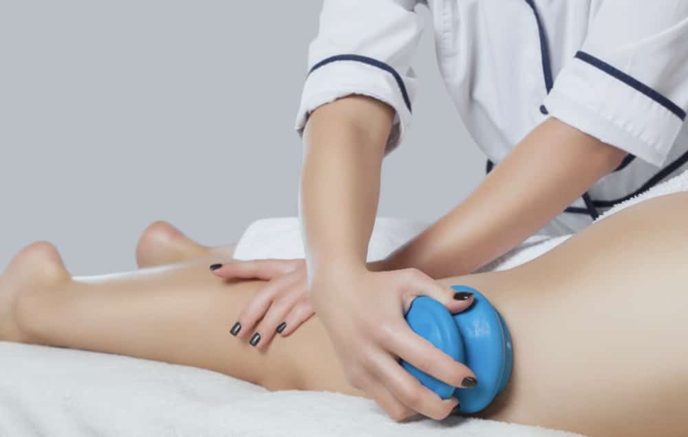 Cupping for Cellulite